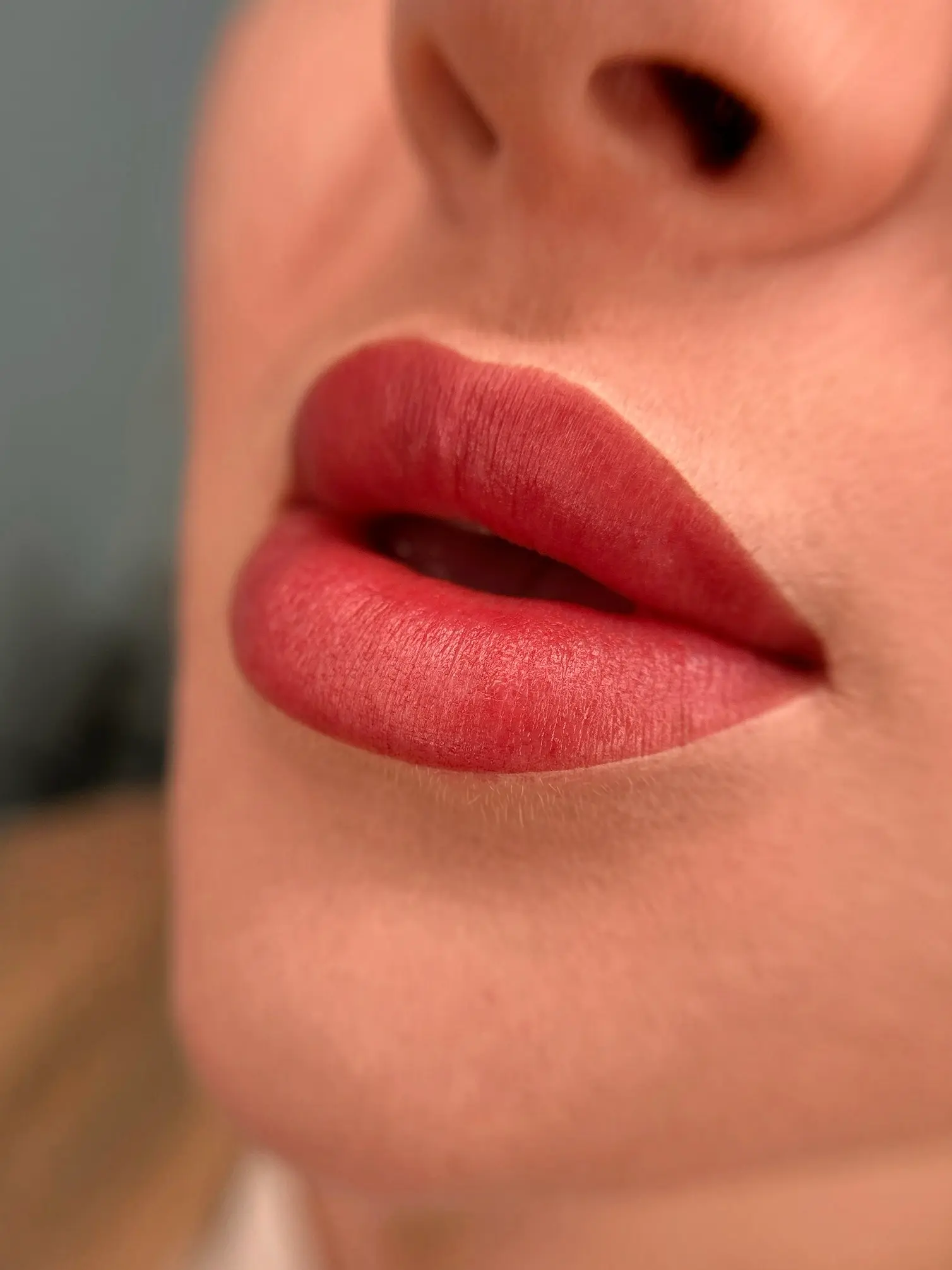 После процедуры